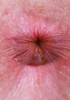 Apricot Pitts from ATK Natural & Hairy