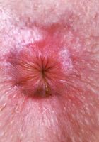 ATK Natural & Hairy: Apricot Pitts (Apricot Pitts shows off her one-piece)