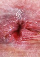 Beverly Hillson's pussy is on full display, Beverly Hillson (bev003) ATK Petites: Beverly Hillson (Beverly Hillson's pussy is on full display)