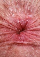 ATK Galleria: Daydream Daisy (Daydream Daisy in her onesie)