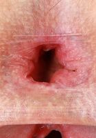 Fiona Frost Gapes her Holes, Fiona Frost (fio011) ATK Galleria: Fiona Frost (Fiona Frost Gapes her Holes)
