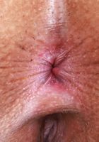 Kate Legend Spreading Shaved Pussy, Kate Legend (kat247) ATK Petites: Kate Legend (Kate Legend Spreading Shaved Pussy)