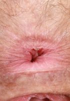 Lauren Laurent in scary hairy, Lauren Laurent (lau067) ATK Natural & Hairy: Lauren Laurent (Lauren Laurent in scary hairy)