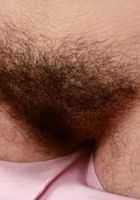 Urtica in scary hairy, Urtica (urt001) ATK Natural & Hairy: Urtica (Urtica in scary hairy)