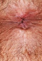 Zoey Jpeg Lingerie Strip, Zoey Jpeg (zoe049) ATK Natural & Hairy: Zoey Jpeg (Zoey Jpeg Lingerie Strip)
