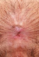 Hairy Fun Galore With Zoey Jpeg and Her Extremely Hairy Holes, Zoey Jpeg (zoe049) ATK Natural & Hairy: Zoey Jpeg (Hairy Fun Galore With Zoey Jpeg and Her Extremely Hairy Holes)